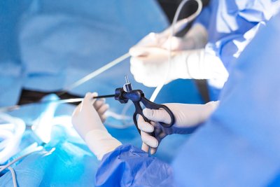 Global Vascular株式会社への出資に関するお知らせ | お知らせ